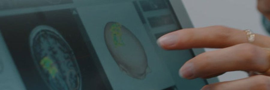 Učinki in namen TPS terapije pri Nevrocentru