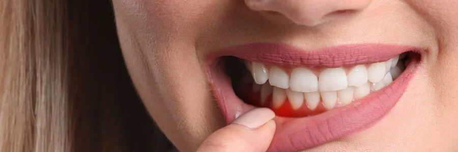 Odkrijte sodobno parodontologijo za zdrave dlesni