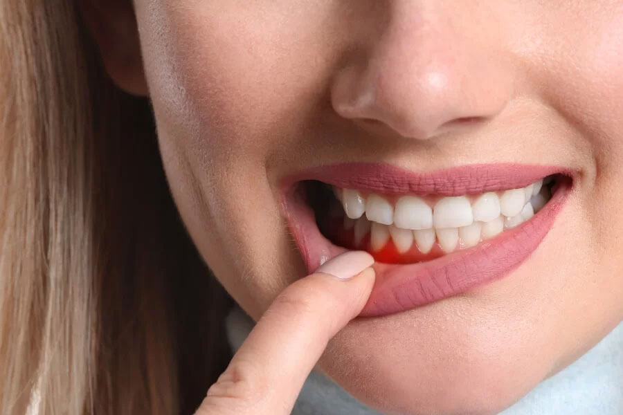 Odkrijte sodobno parodontologijo za zdrave dlesni